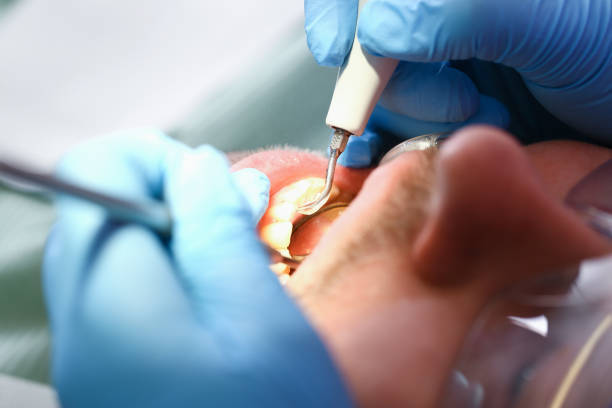Best Tooth Infection Emergency Dentist  in National Harbor, MD