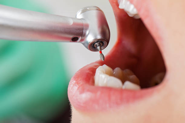 Best Urgent Tooth Repair  in National Harbor, MD